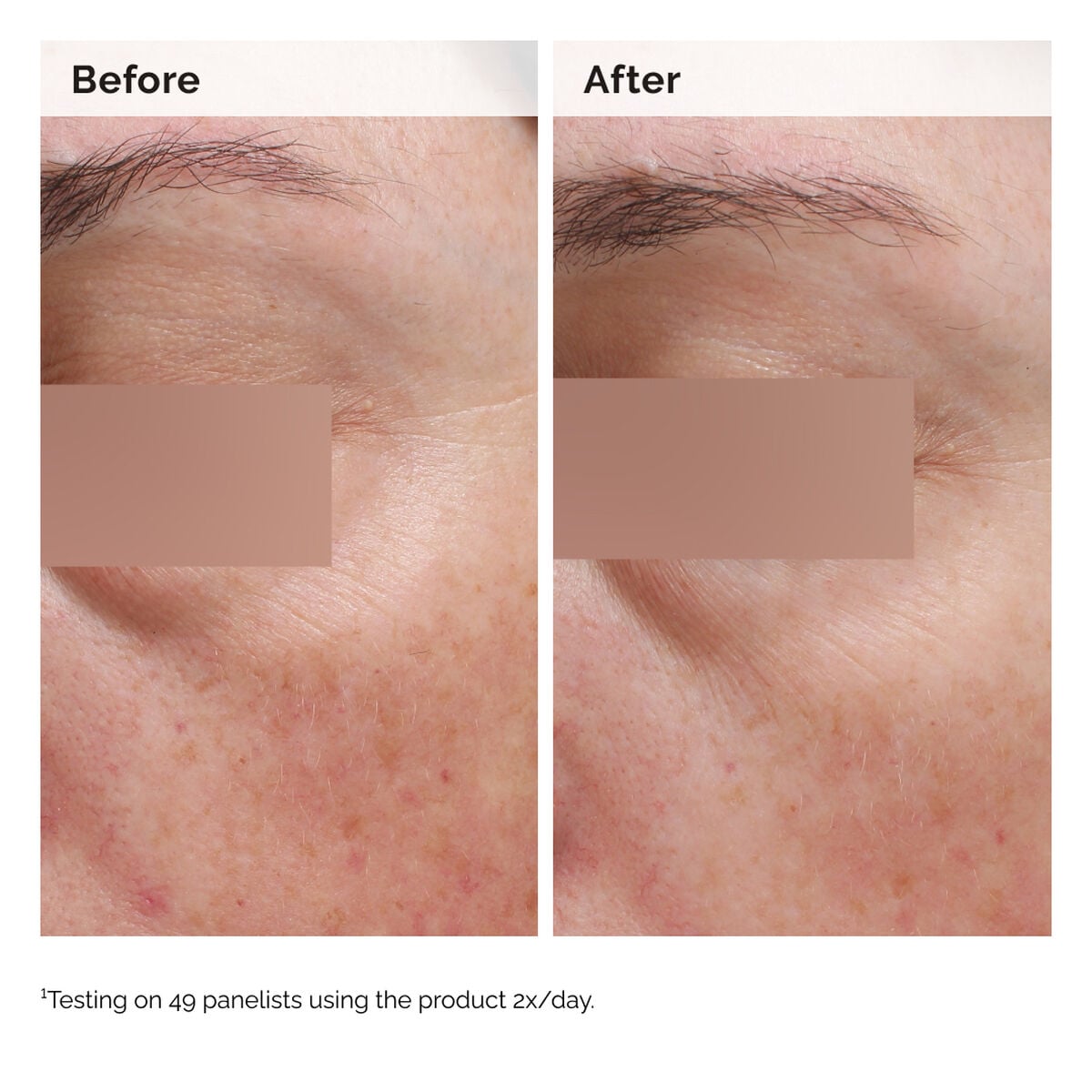 niacinamide-5-face-and-body-emulsion-r3 2024-08-23-ORD-Nia-5pct-Face-Body-B-A-Elasticity-Global-02-1x1.jpg