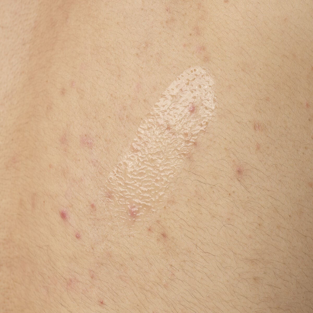 salicylic-acid-0-5-body-serum-s8 ORD-salicylic-acid-05-body-240ml-application.jpg