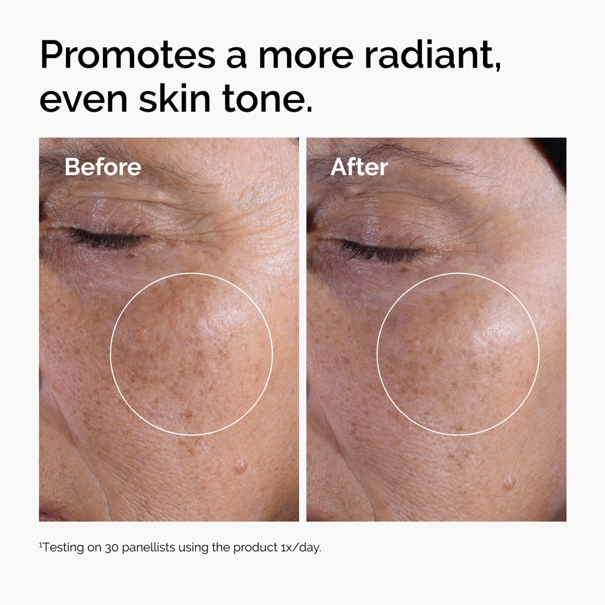 glycolic-acid-7-exfoliating-toner-u9 ord-glycolic-before-after-radiance.jpg