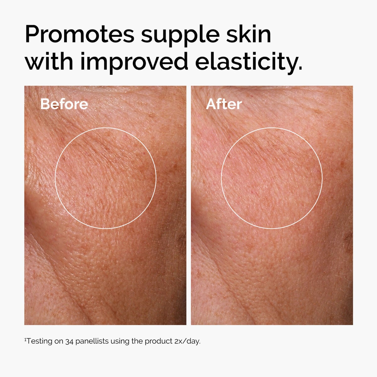 hyaluronic-acid-2-b5-with-ceramides-e2 ord-hyaluronic-acid-2pct-b5-hydrating-serum-before-after-elasticity.jpg
