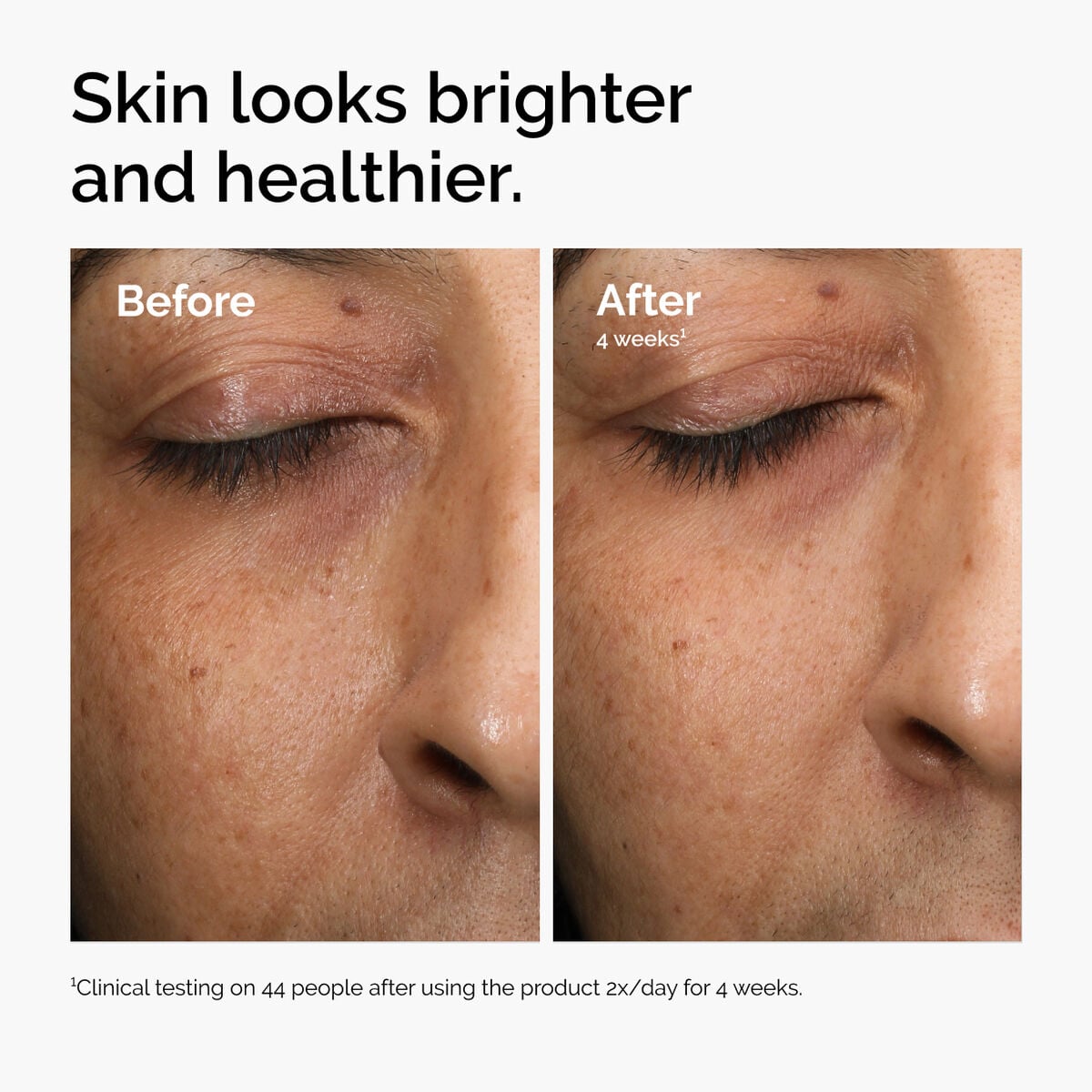 multi-antioxidant-radiance-serum-d7 ord-mars-before-after-healthy.jpg