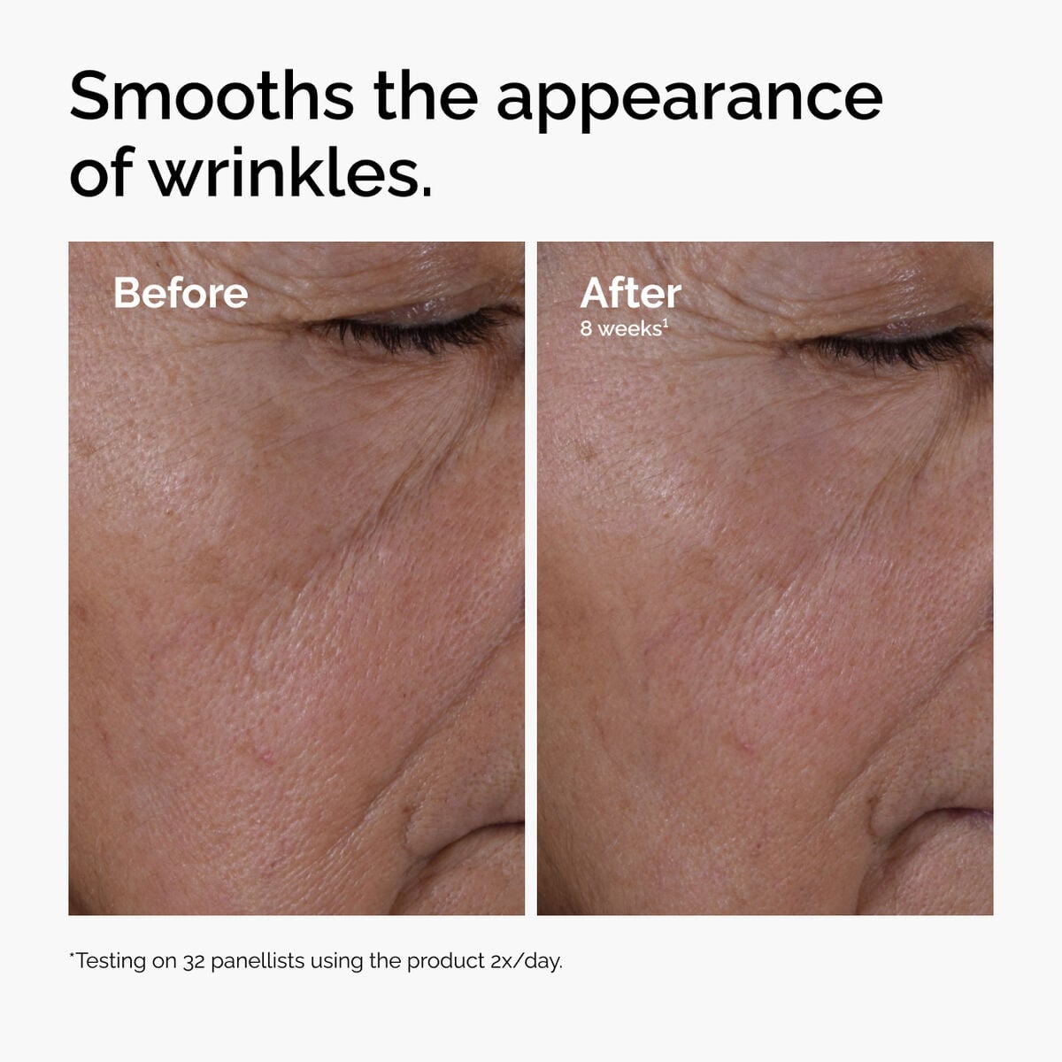 multi-peptide-ha-serum-d0 ord-multi-peptide-ha-serum-wrinkles-before-after.jpg