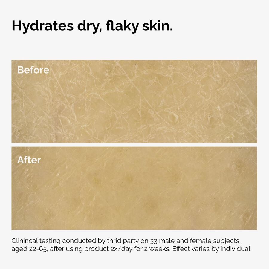 the-body-care-collection-j8 ord-natural-moisturizing-factors-inulin-body-before-after-graphic-02.jpg