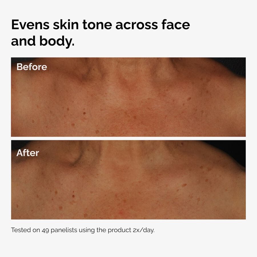 the-body-care-collection-j8 ord-niacinamide-face-body-serum-before-after-even-tone-graphic.jpg