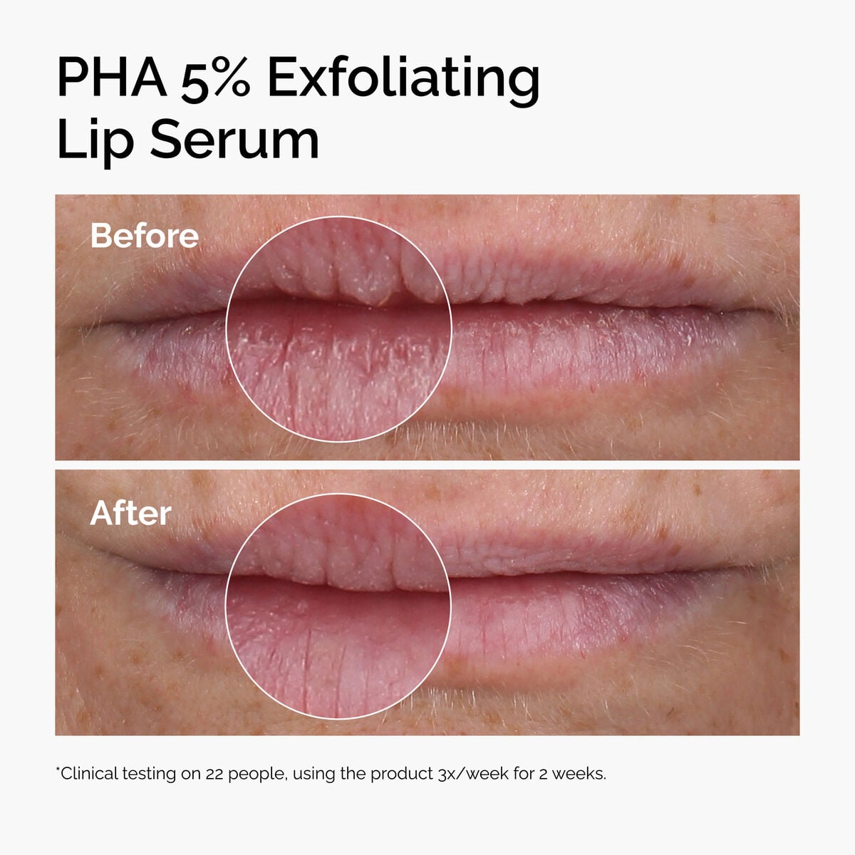 pha-5-exfoliating-lip-serum-w9 ord-pha-5pct-lip-exfoliating-serum-before-after.jpg