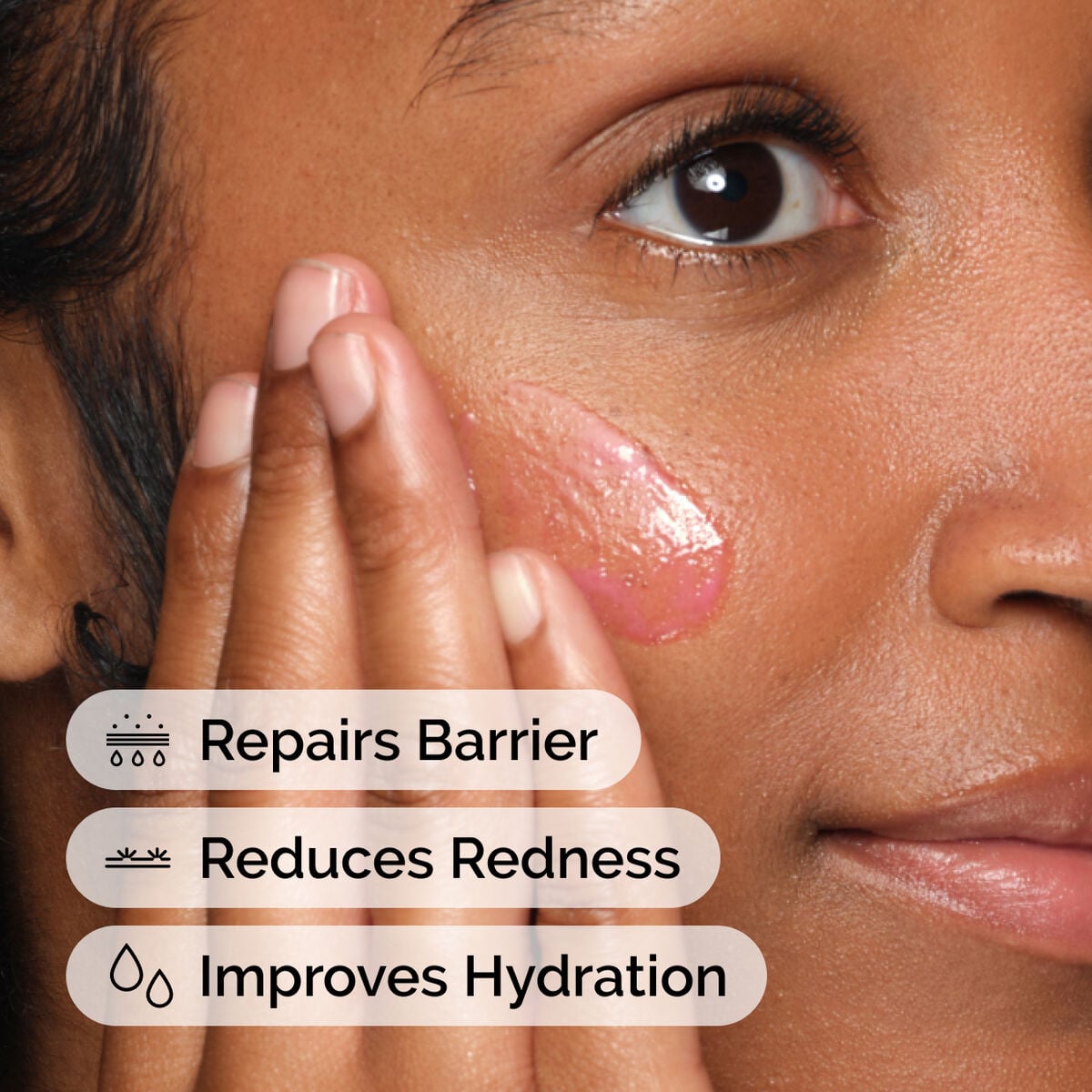 soothing-and-barrier-support-serum-a5 ord-soothing-barrier-support-serum-model-application-with-benefits.jpg